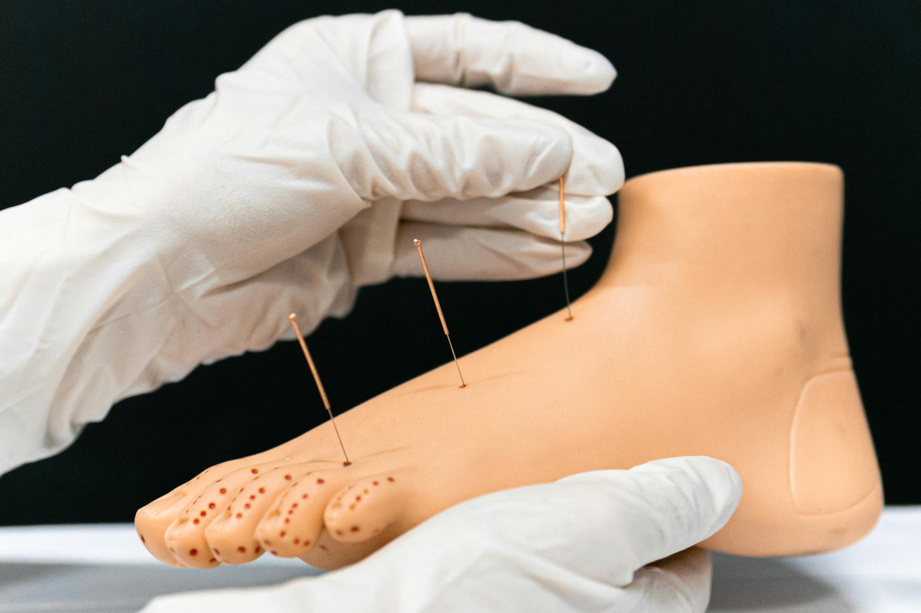 Stopa z igłami do dry needling w modelu anatomicznym